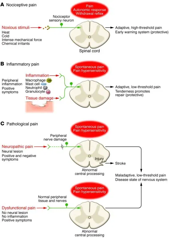 The 3 Types of pain