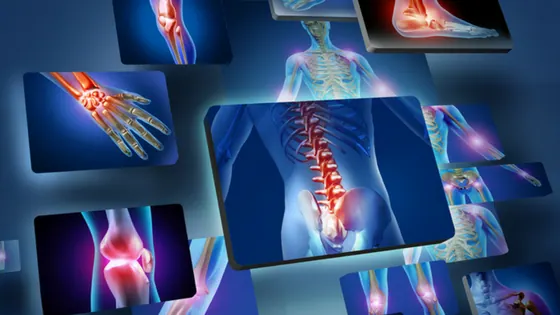 Why We Experience Pain